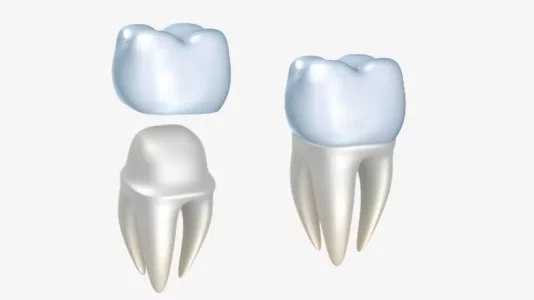 couronnes-dents-1280x720.webp