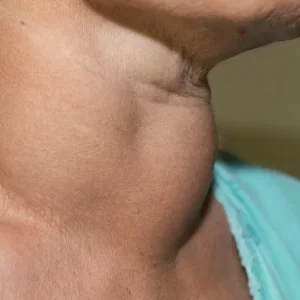 i107622-.webp