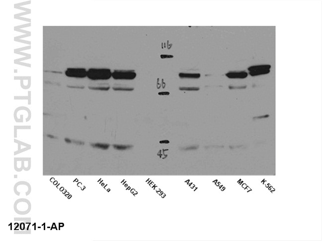 STAT5B-Antibody-12071-1-AP-A108WB.jpg