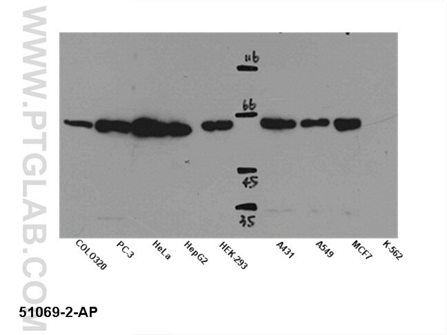 ERK1-Antibody-11257-1-AP-A116WB.jpg
