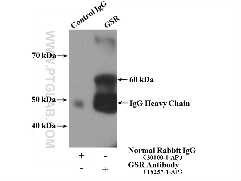 GSR-Antibody-18257-1-AP-IP-54452.jpg