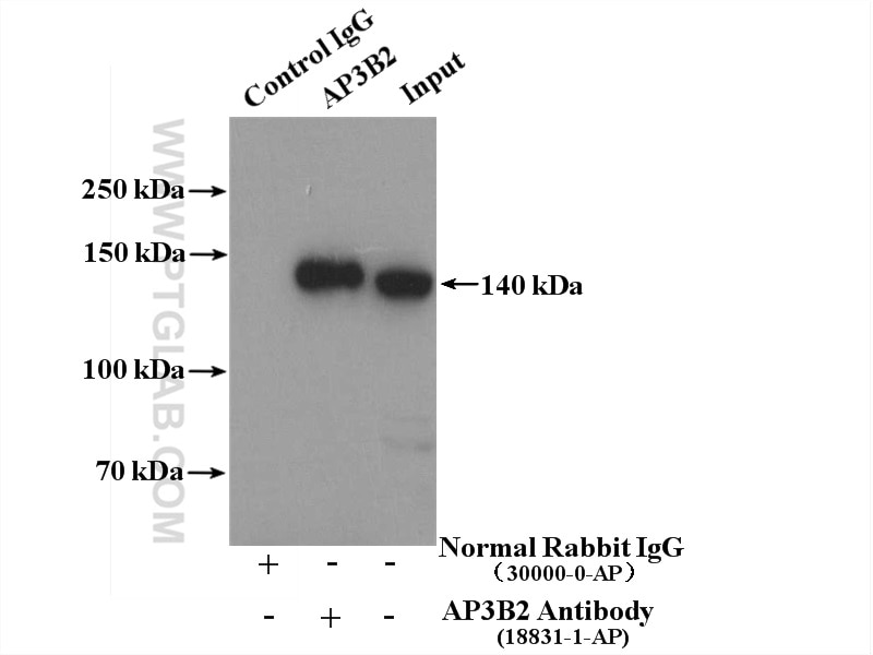 AP3B2-Antibody-18331-1-AP-IP-67181.jpg